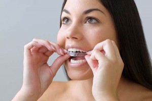 comment avoir rapidement des dents blanches